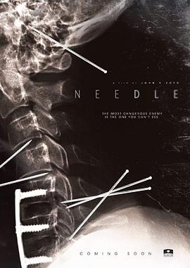 针 Needle