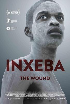 <span style='color:red'>伤</span>口 Inxeba