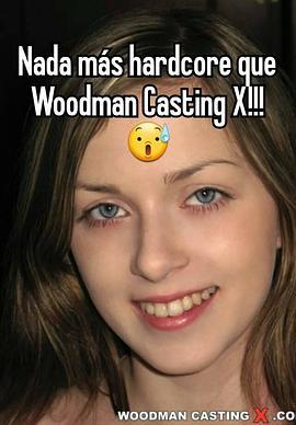 Woodman Casting X
