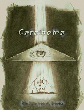 肿瘤 Carcinoma