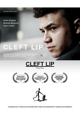 唇裂 Cleft Lip