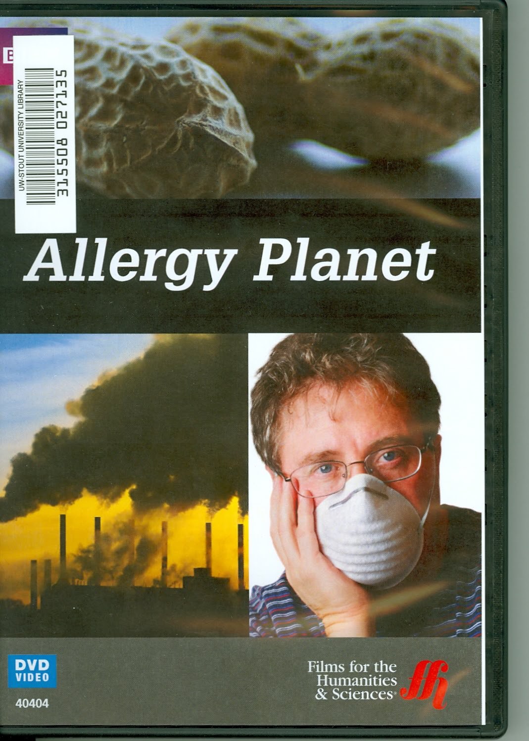 地平线系列：过敏世界 Horizon : Allergy Planet